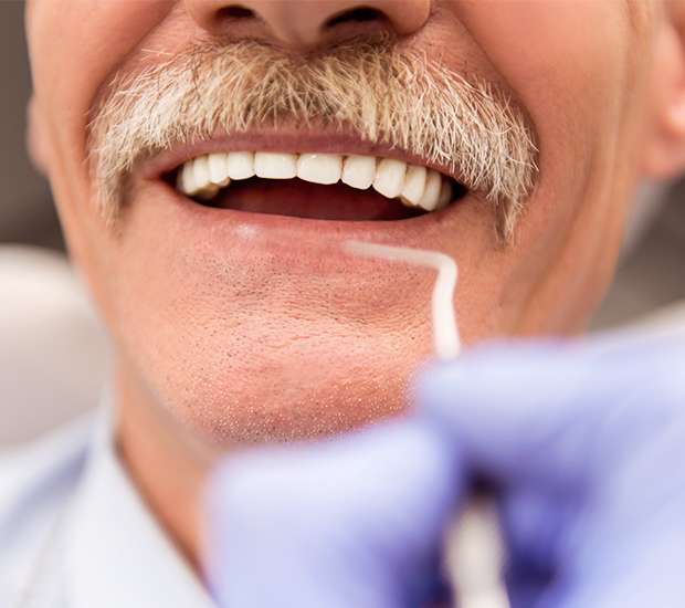 Auburn Hills Adjusting to New Dentures