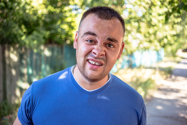 How A Dentist Can Treat A Broken Tooth