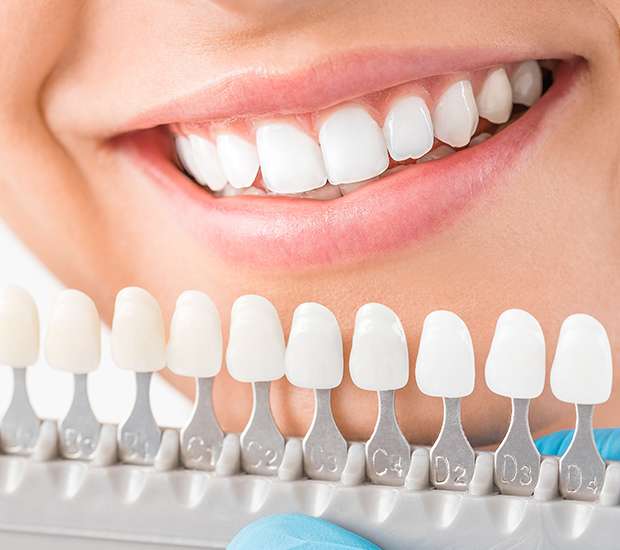 Auburn Hills Cosmetic Dentist