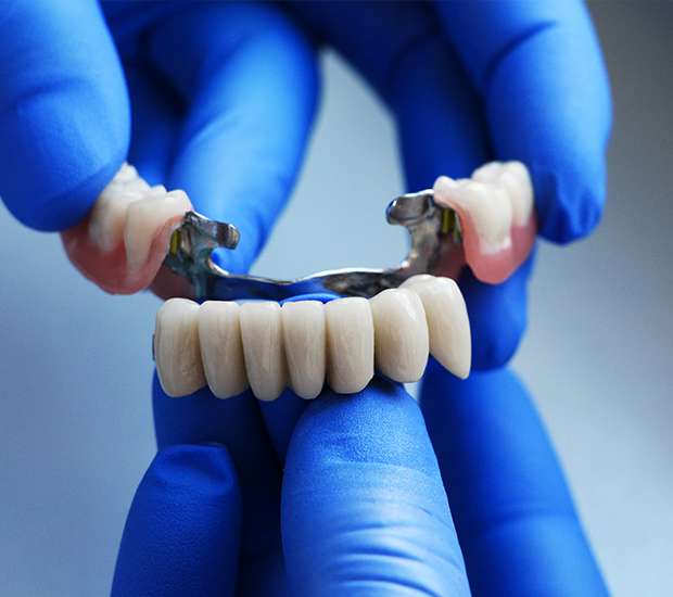 Auburn Hills Dental Bridges