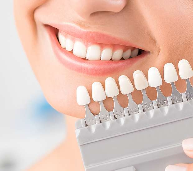 Auburn Hills Veneers