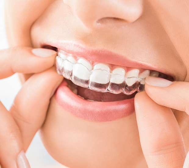 Auburn Hills Does Invisalign® Really Work?