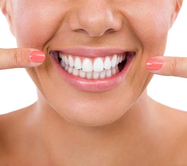 Auburn Hills What Is Gum Contouring and Reshaping