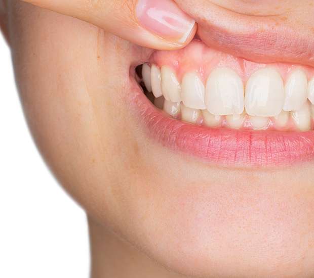 Auburn Hills Gum Disease