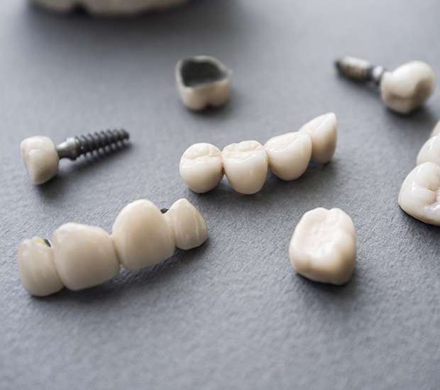 Auburn Hills The Difference Between Dental Implants and Mini Dental Implants