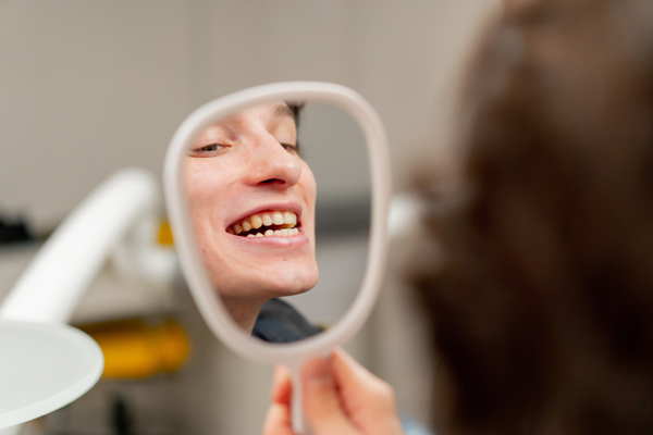 FAQs On Take Home Teeth Whitening Trays