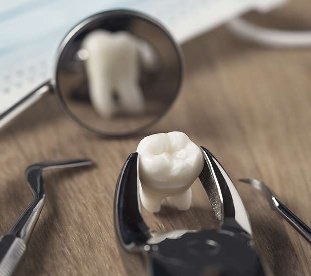 Auburn Hills When Is a Tooth Extraction Necessary
